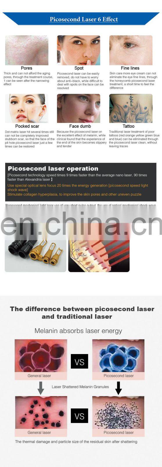 755nm New Style Picosecond Laser Tattoo Removal Machine Factory Price for Sale