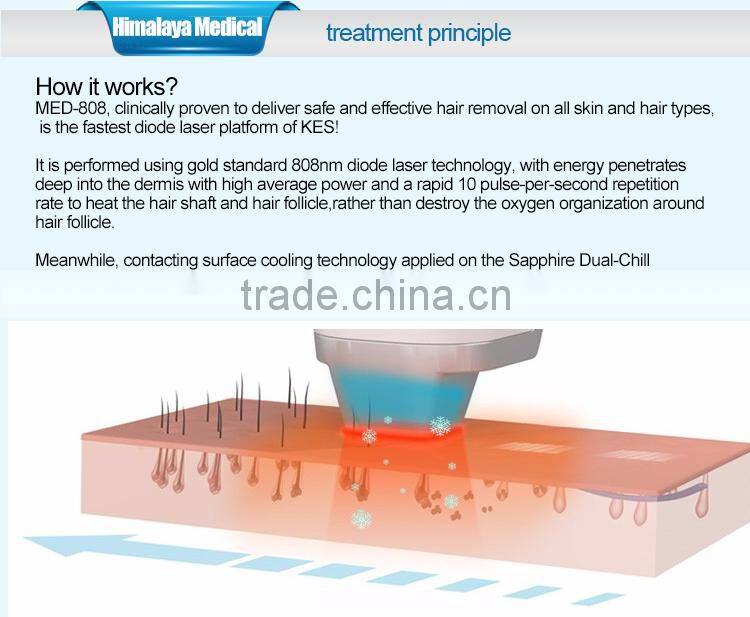 High Quality germany 808nm diode laser hair removal machine