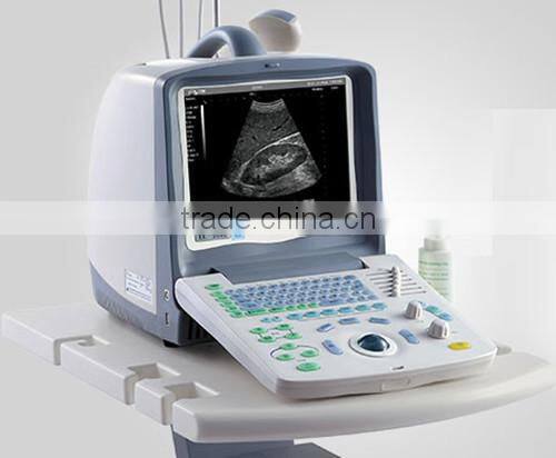 Portable musculoskeletal ultrasound machine