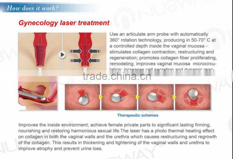 Vertical 40W Medical CE approved RF Pipe Fractional co2 laser pigment removal Gynecology treatment laser equipment