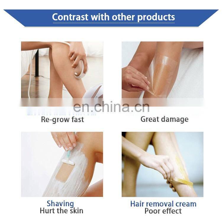 diode 808 diode laser hair removal machine