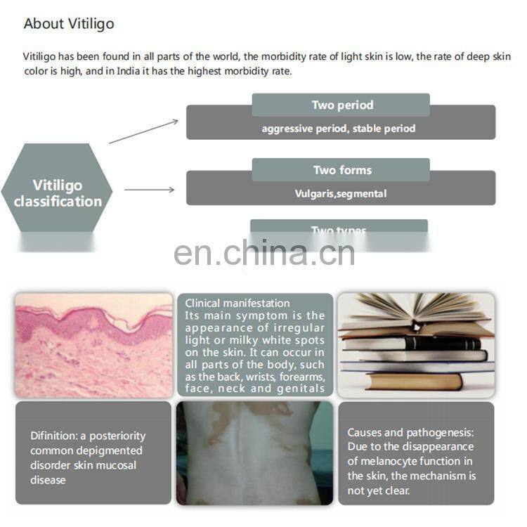 308nm excimer laser vitiligo phototherapy instrument genuine home UVB UV treatment machine