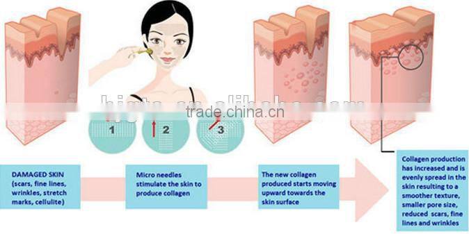 GTO brand new micro needle roller 192 derma roller derma skin roller
