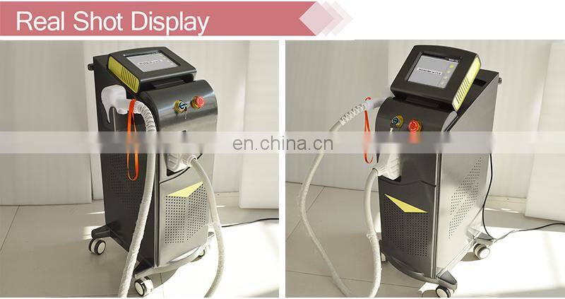 Alma Soprano ICE 808 hair removal machine Israel Germany laser