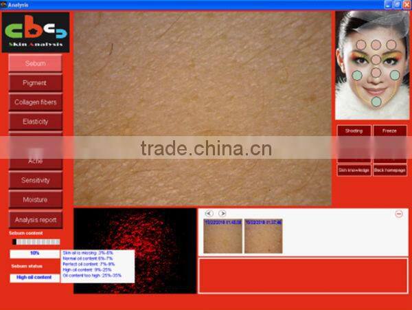 2014 Newest 3D Skin Analyzer