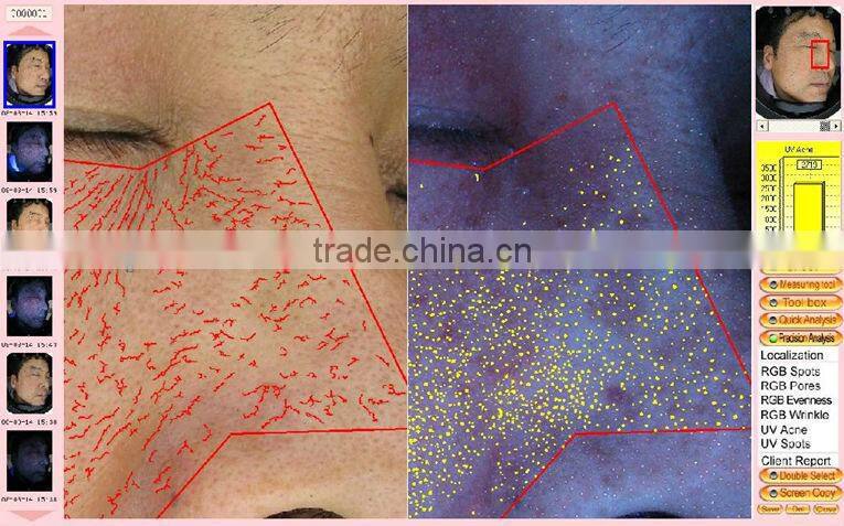 China Best Selling Bauty Machine: high performance mini skin analyzer handheld skin analyzer with CE