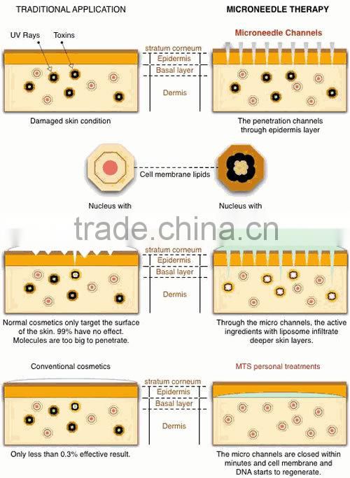 Disk needle therapy derma roller which you can buy from Lumsail