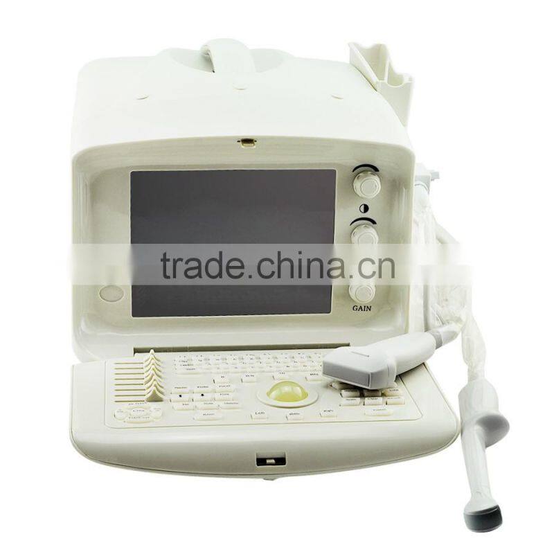 High sensitivity Trolley style Digital Portable Ultrasound Scanner with 2 probe connector