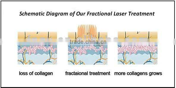 Modern new arrival fractional radio frequency equipment