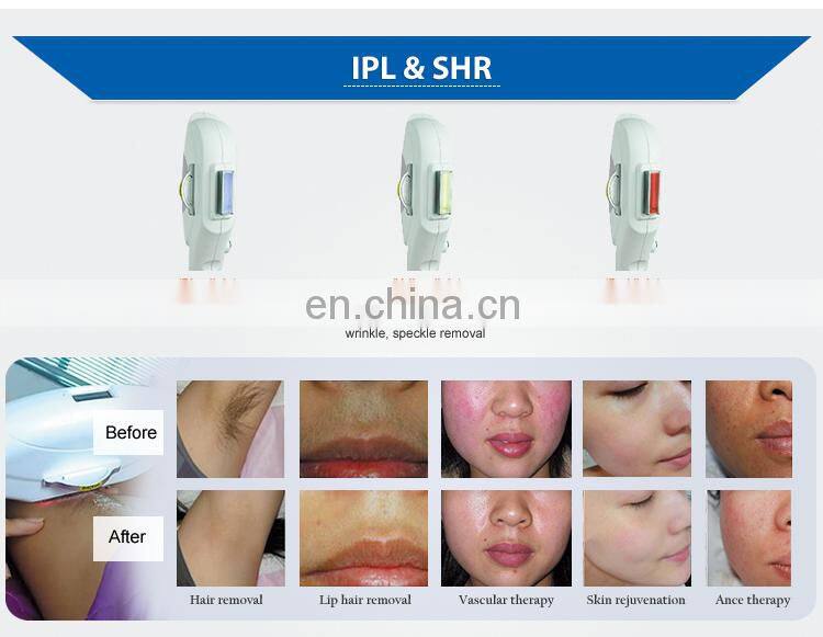 IPL Permanent SHR Laser Hair Removal Home Use Machine Factory Direct Sales