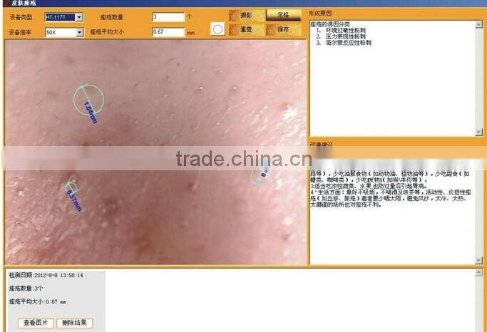 AYJ-J019 facial Skin Moisture Monit analyzer/digital skin analyzer