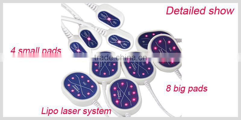 New RF Cavitation Vacuum liposuction cryolipolisis lipo laser cryolipolysis&rf beauty machine