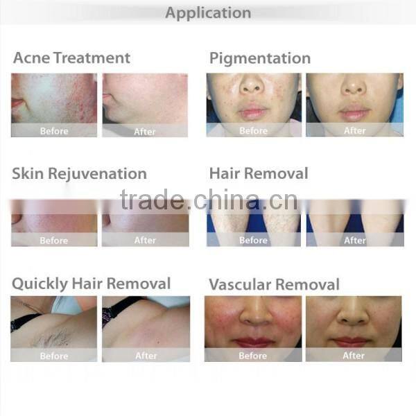 Multifunction 4 in 1 hair removal ipl elight nd yag laser aesthetics