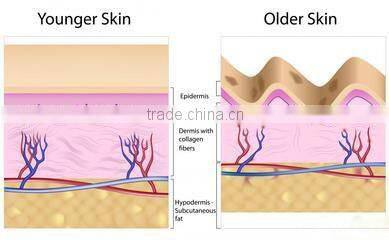 Merry christmas present !portable hifu rf wrinkle removal skin tightening machine for home use
