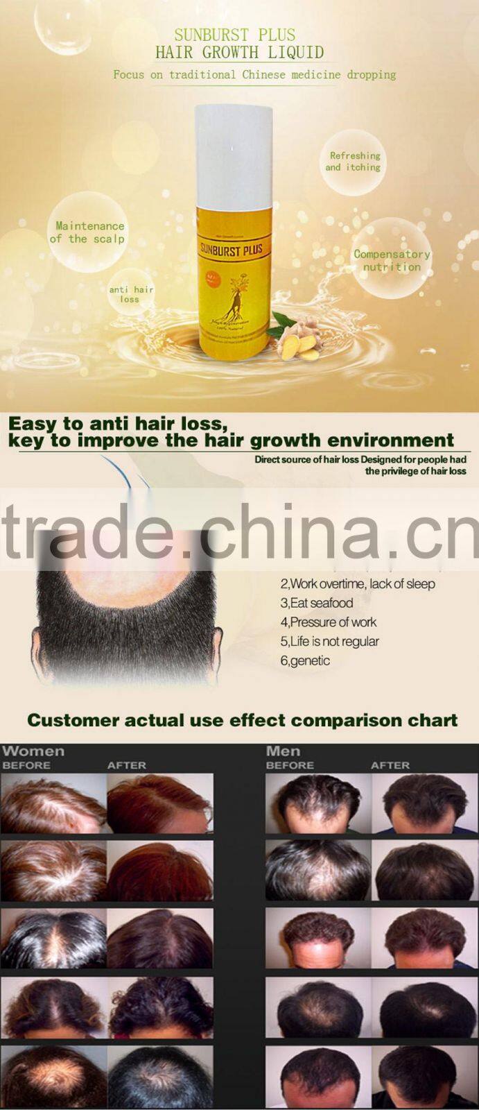 Sunburst Plus Hair Growth Lotion NEW UPGRADE 100ml