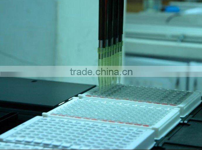 chemiluminescence immunoassay systems sale