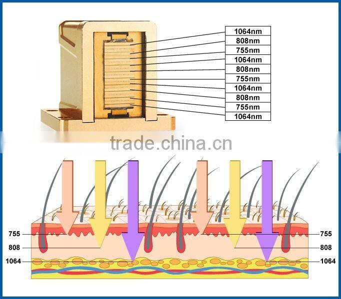 National day promotion High Quality 810nm Diode Laser Medical 808nm diode laser hair removal