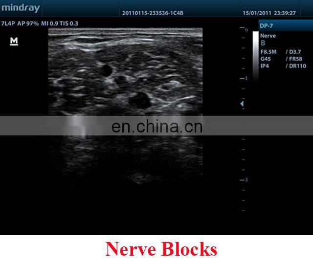 DP-7 Factory Price Mindray trolley Full digital DP-7 ultrasound machine price