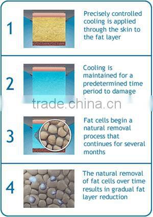 Dual cryo heads cryo lipolisis portable freezing slimming machine CTL76