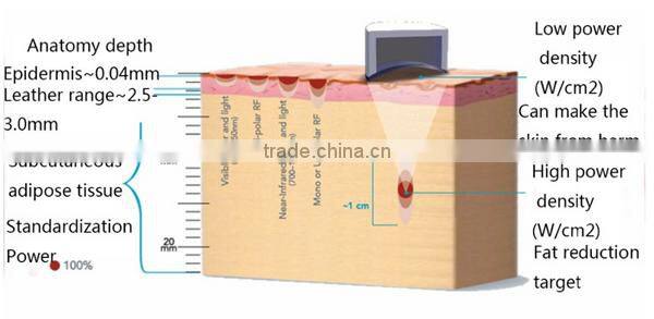 Portable non-surgical liposonix high intesity foucused ultrasound body slimming portable HIFU slimming