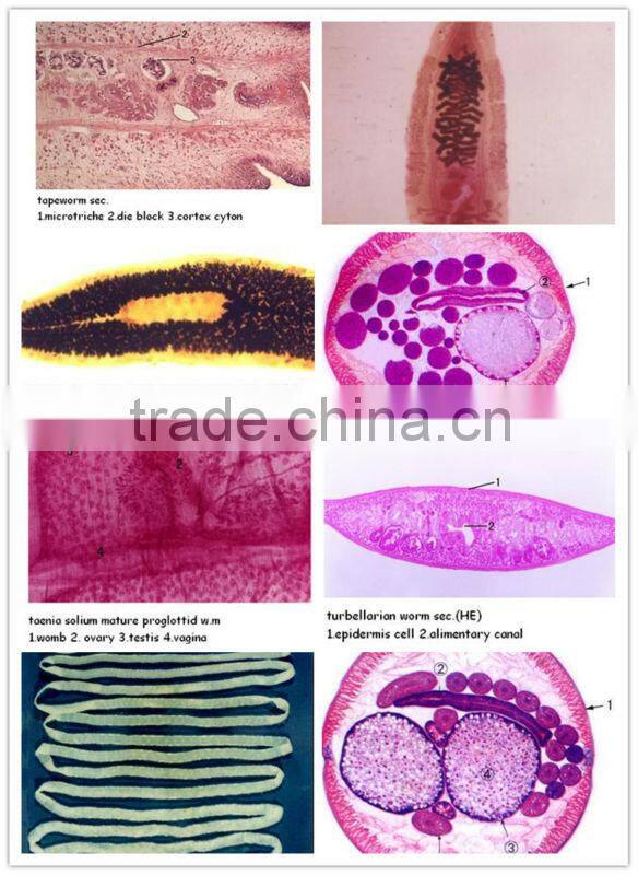 medical parasitological prepard slides amoeba section set