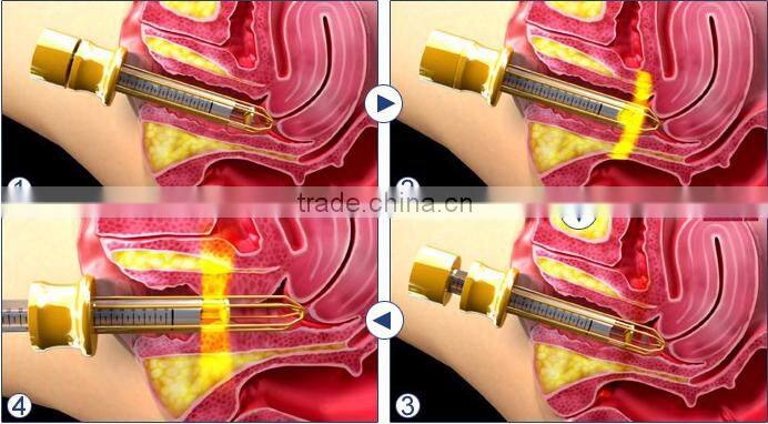 Professional ODM /OEM service 10600nm skin resurfacing & vaginal tightening medical fractional co2 equipment