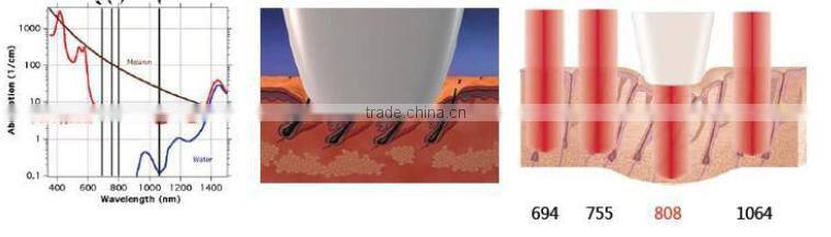 professional laser hair removal machine/P-808 diode laser hair moval