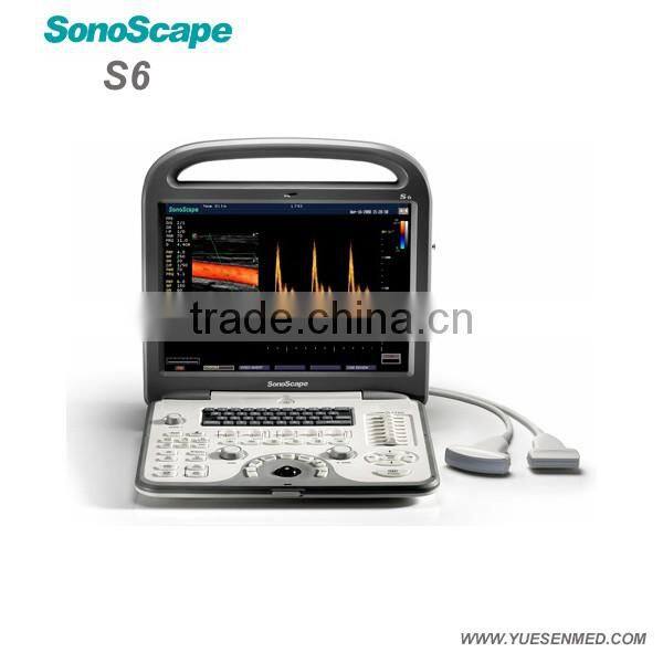 4D Sonoscape S6 Portable ultrasound machine color doppler