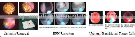 Holmium Laser / Ho Yag Laser HOL-70W