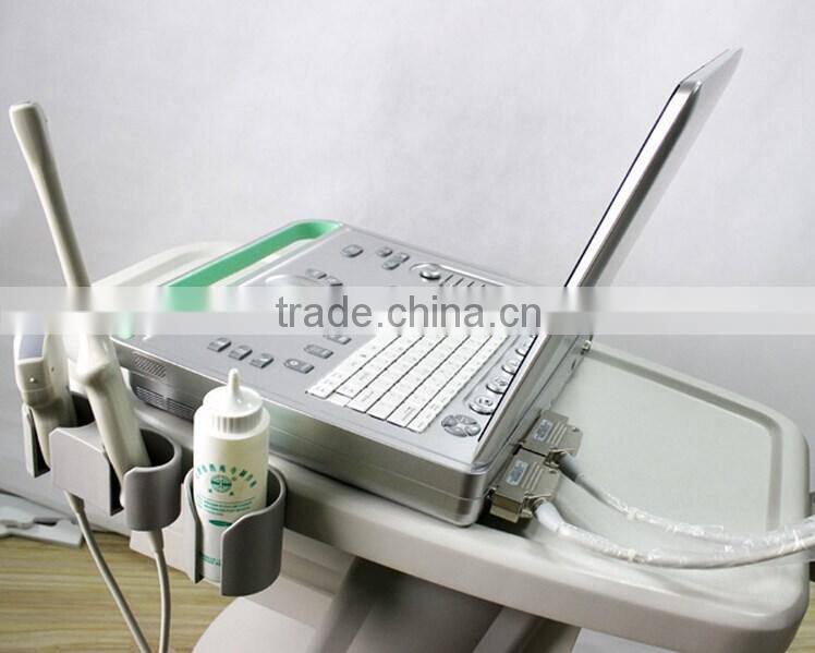 Hot Sale Full Digital Technology Ultrasound Scanner/ Echographe With Ce And Iso
