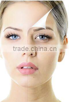 Derma roller/high quality titanium Needles Dermaroller