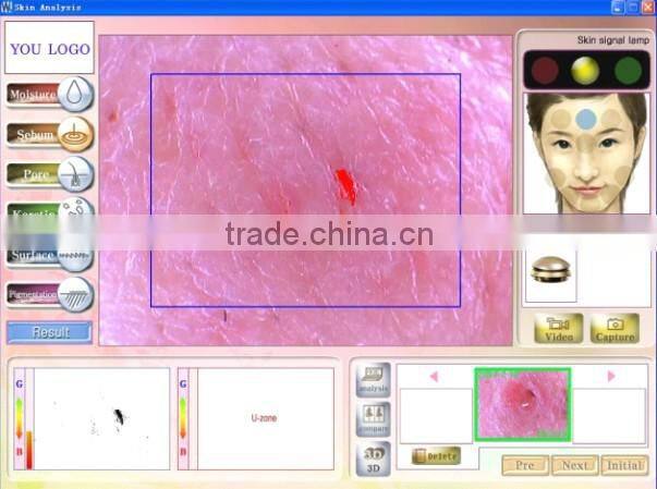 Magic mirror skin analyzer Skin scope analyzer