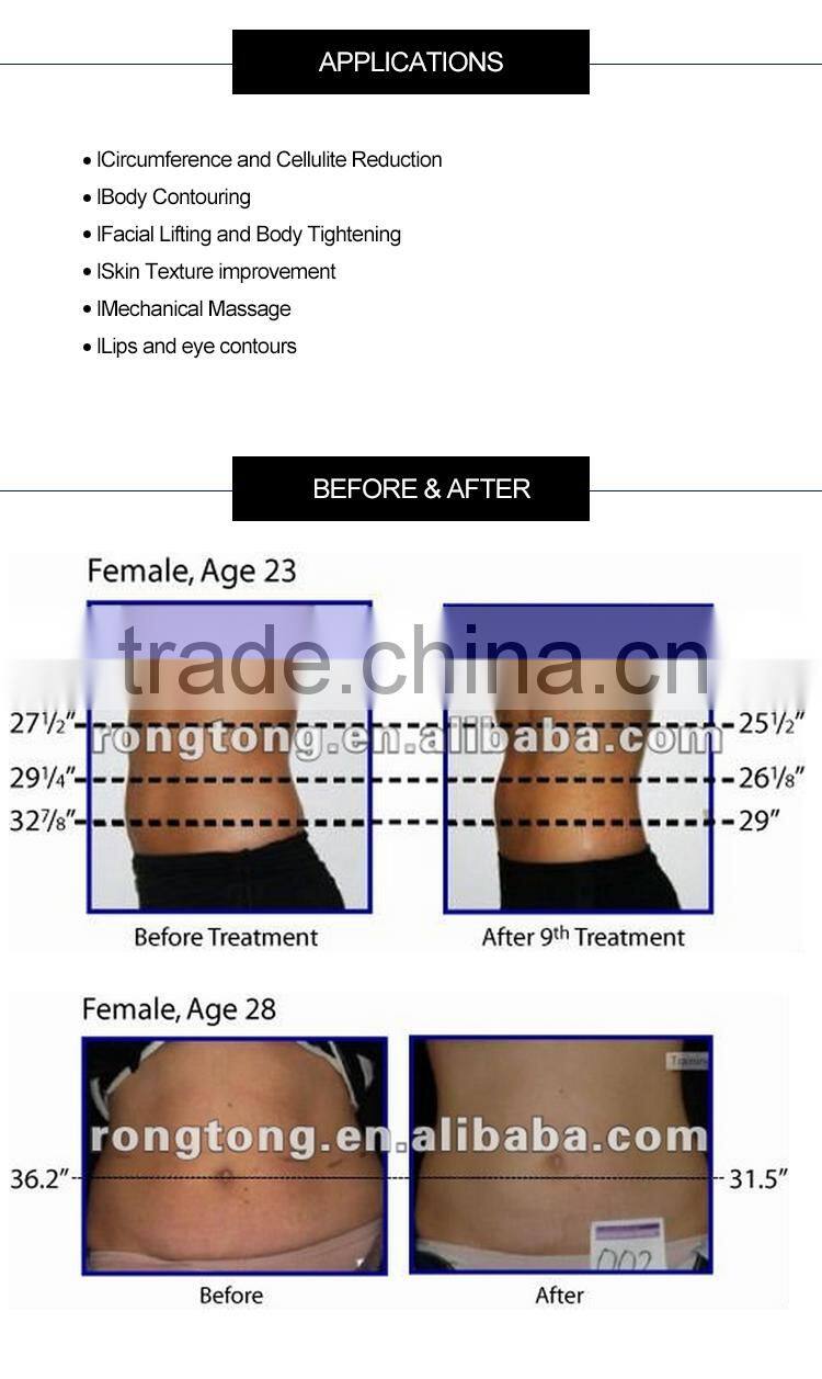 2016 Professional multishape machine price with competitiveness for cellulite removal and body shaping machine