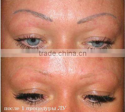 New hot professional type nd yag :laser tatoo remover and freckles remove with CE and GOST-P