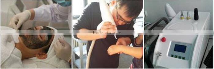 high quality nd yag laser / q-switched nd yag laser for tattoo removal machine