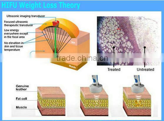 Awesome 2015 hifu body weight loss Equipment, hifu body shape slimming machine