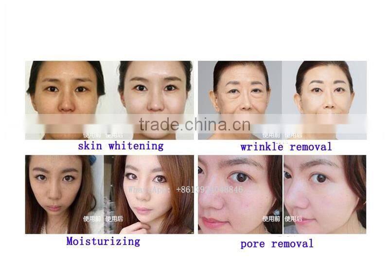 Micro Needle Mesotherapy Gun/auto Microneedle therapy system mesotherapy injection gun