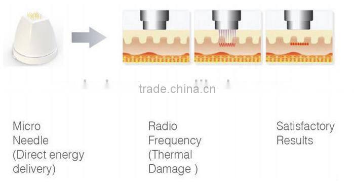 2016 non-invasive thermagic microneedle fractional rf for anti wrinkle