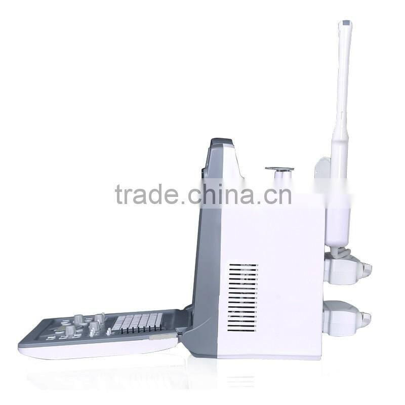promotion price cheapest 3D laptop color doppler ultrasound/doppler ultrasound