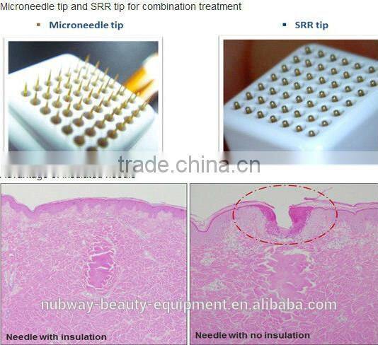 Skin Tightening Fraction Radio Frequency portable rf facial treatment face lifting machine