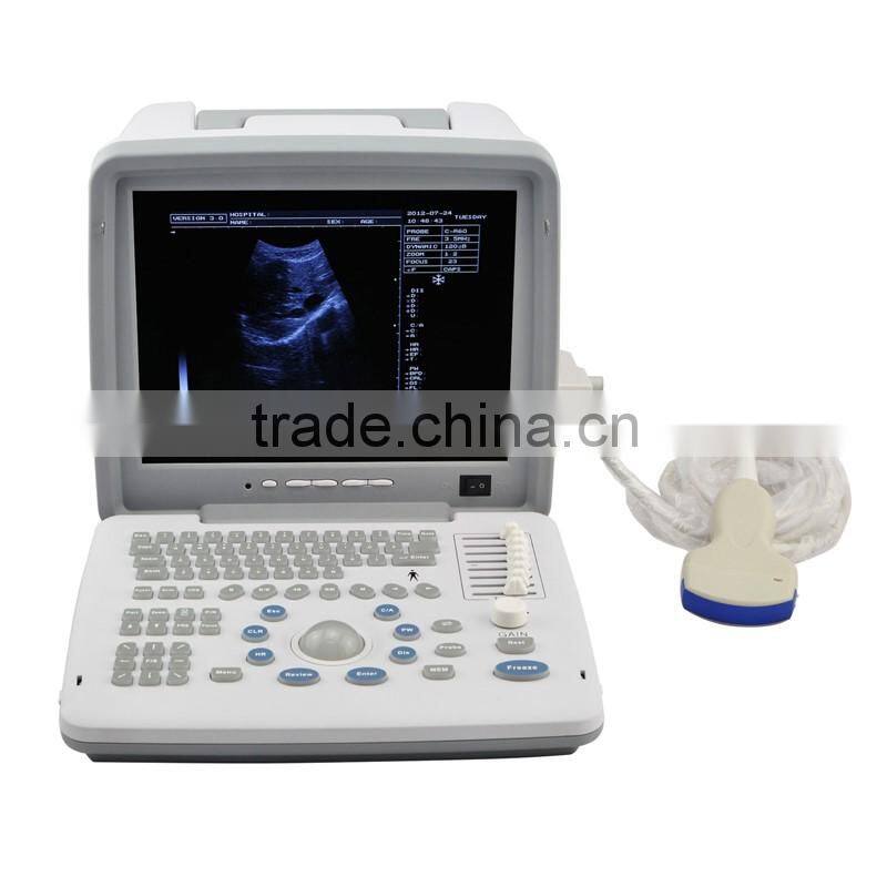 Full Digital LED Ultrasound Scanner B&W ultrasound system
