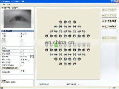 MD-820B Automatic Visual Perimeter instrument