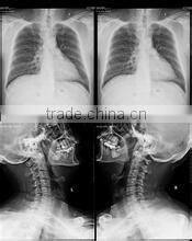 medical film thermal meter printer Medical laser paper film