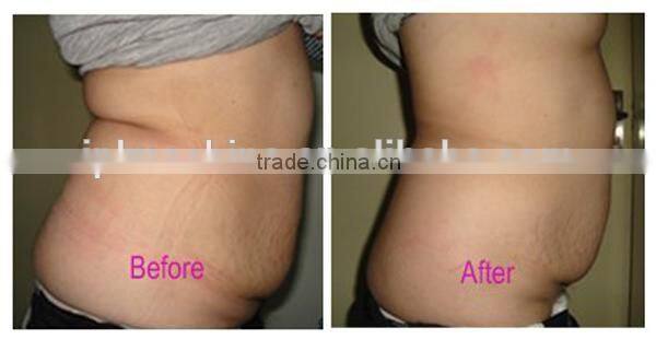 HOTTEST kim 8 new cavitation rf vacuum slimming machine