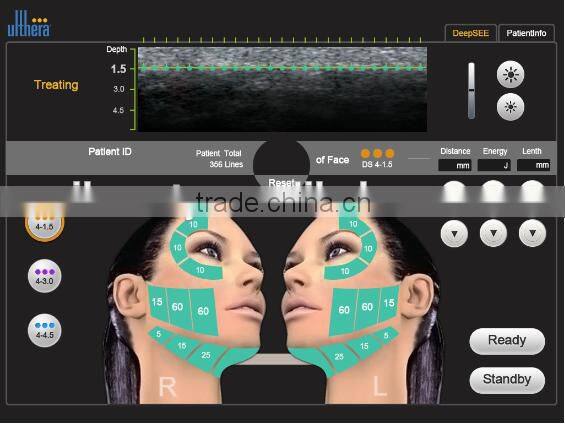 hifu body slimming, hifu face lift& wrinkle removal machine