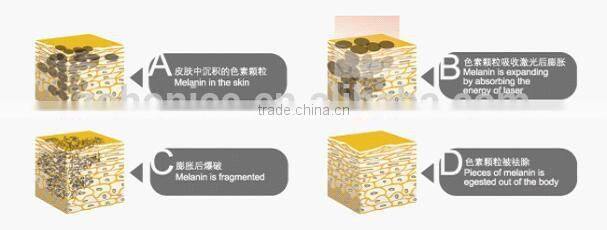 E8B 4in1 IPL RF ELIGHT YAG LASER for skin care