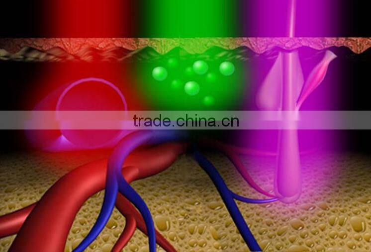 Germany bars portable 808nm diode laser laser hair removal machine for sale