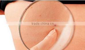 liquid co2 laser plasma pen for spots freckle mole removal