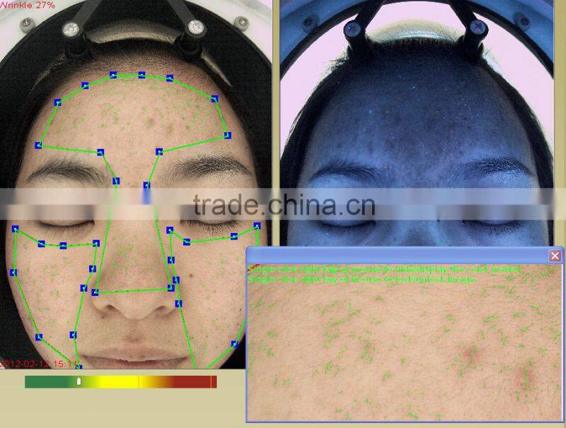 Facial skin moisture oil analyser/Skin Moisture Tester