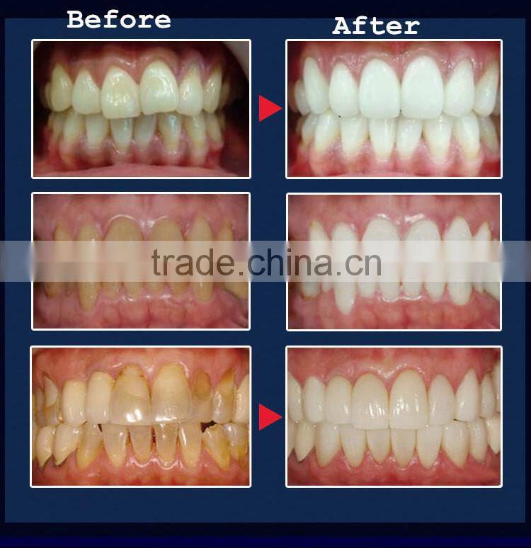 wholesale 3d non peroxide teeth whitening strips